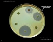 antibiotics resistant bacteria